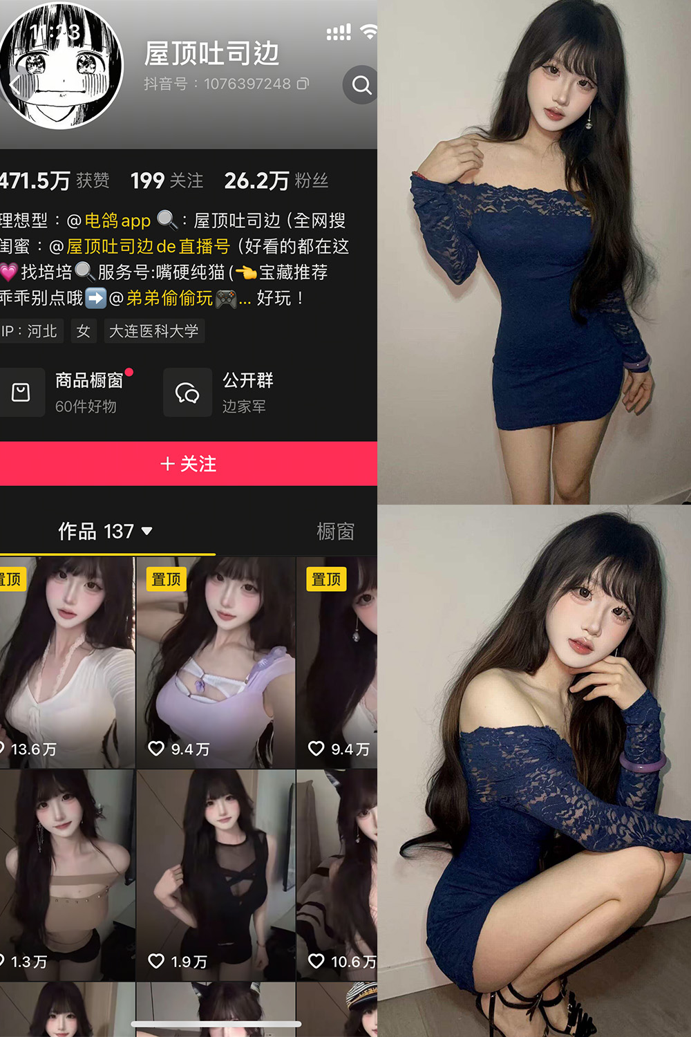 抖音 屋顶吐司边  NO.001期 【10P11V】